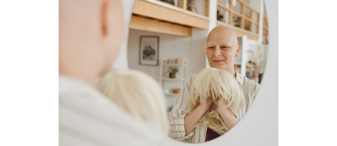 Jak uporać się z problemem wypadających włosów po chemioterapii?