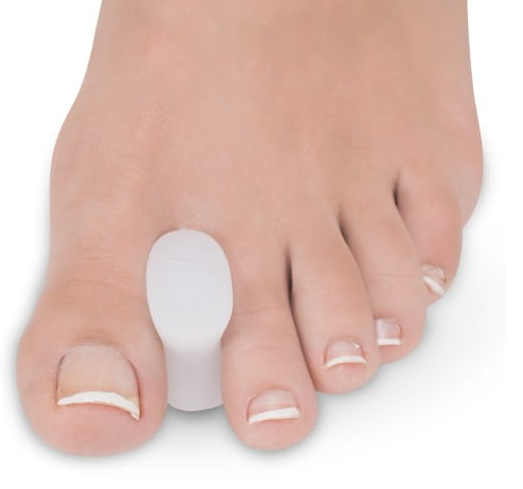 Stopa z odciętym palcem i białym urządzeniem na dużym palcu, prawdopodobnie proteza lub aparat ortopedyczny.