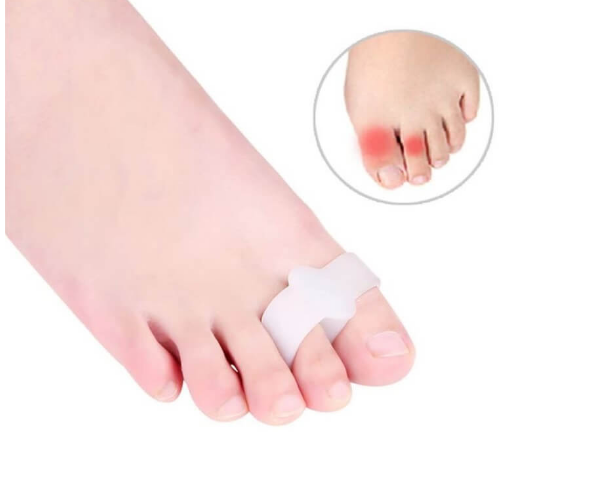 Palec u nogi z odciskami i zaczerwienieniem, z opatrunkiem na dużym palcu.