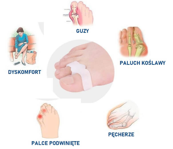 Ból w palcach, stawie, podbiciu, pęcherzu i paluchu koślawym, wskazujące na różne dolegliwości stóp.