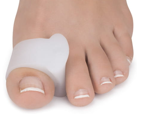 Palec u nogi z odciętą końcówką, na której znajduje się biały opatrunek lub proteza.