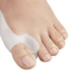 Palec u nogi z nakładką ortopedyczną na dużym palcu, służącą do korekcji lub ochrony.