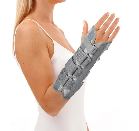 Kobieta z unieruchomioną ręką w gipsowym opatrunku na przedramieniu, uniesiona do góry.