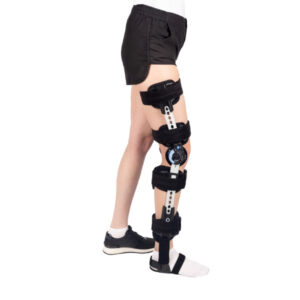 Kobieta na jednej nodze z unieruchomioną kończyną, założoną na nią ortezą z regulowanymi paskami i mechanizmem ustawi